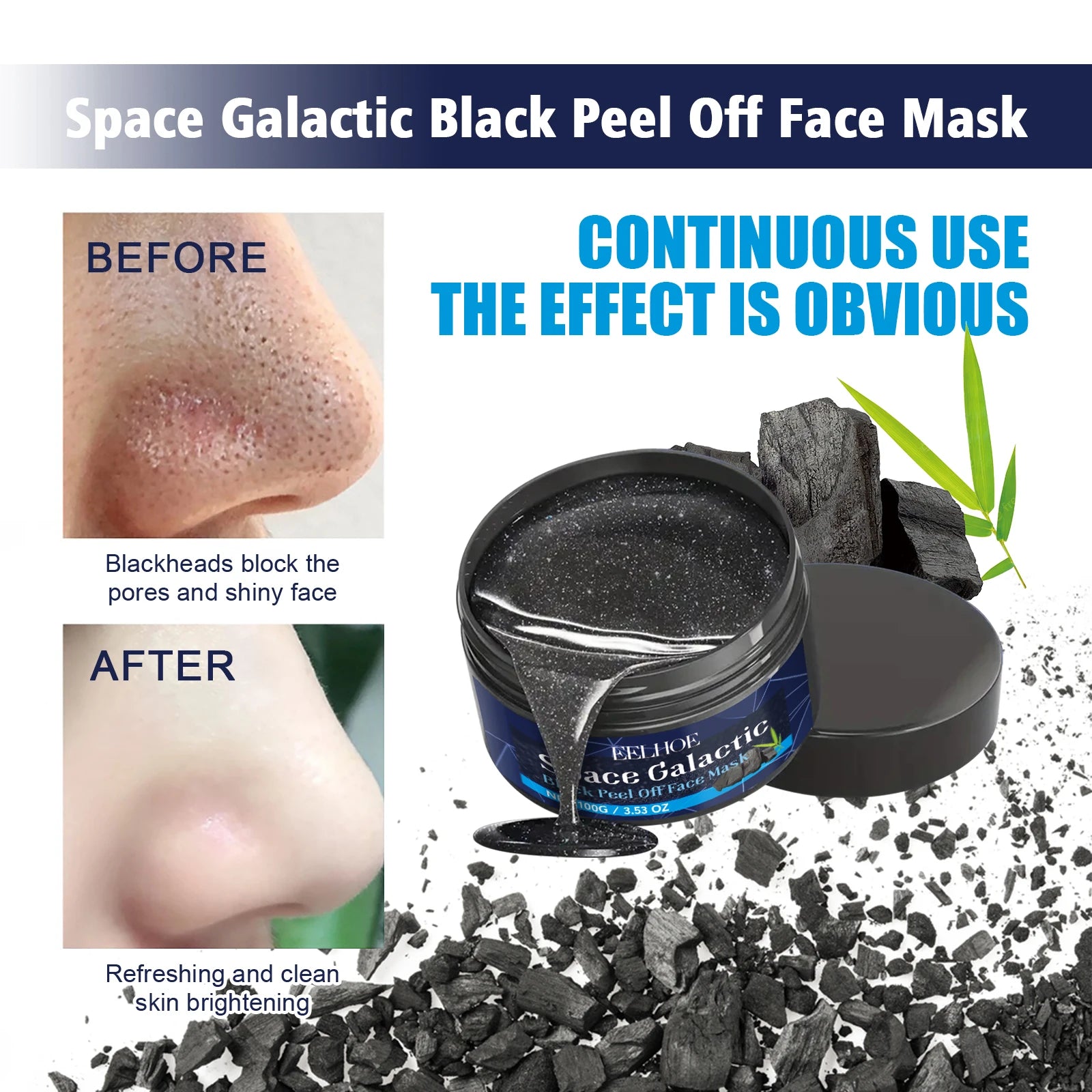Blackhead mask acne deep cleansing - Stylish Expression
