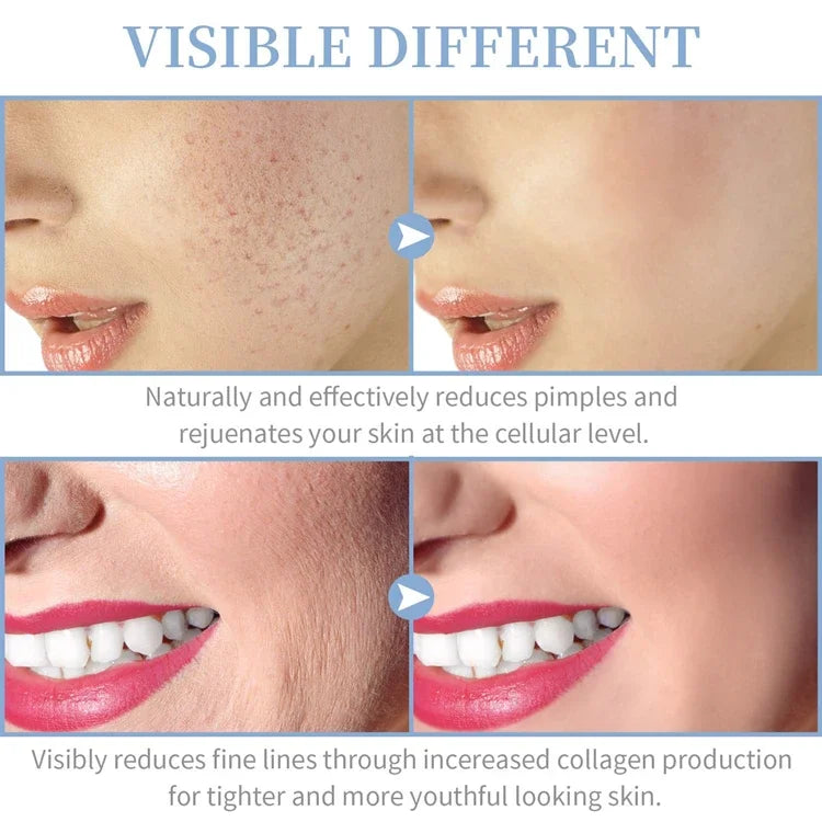 Portable High Frequency Facial Therapy Wand - Stylish Expression