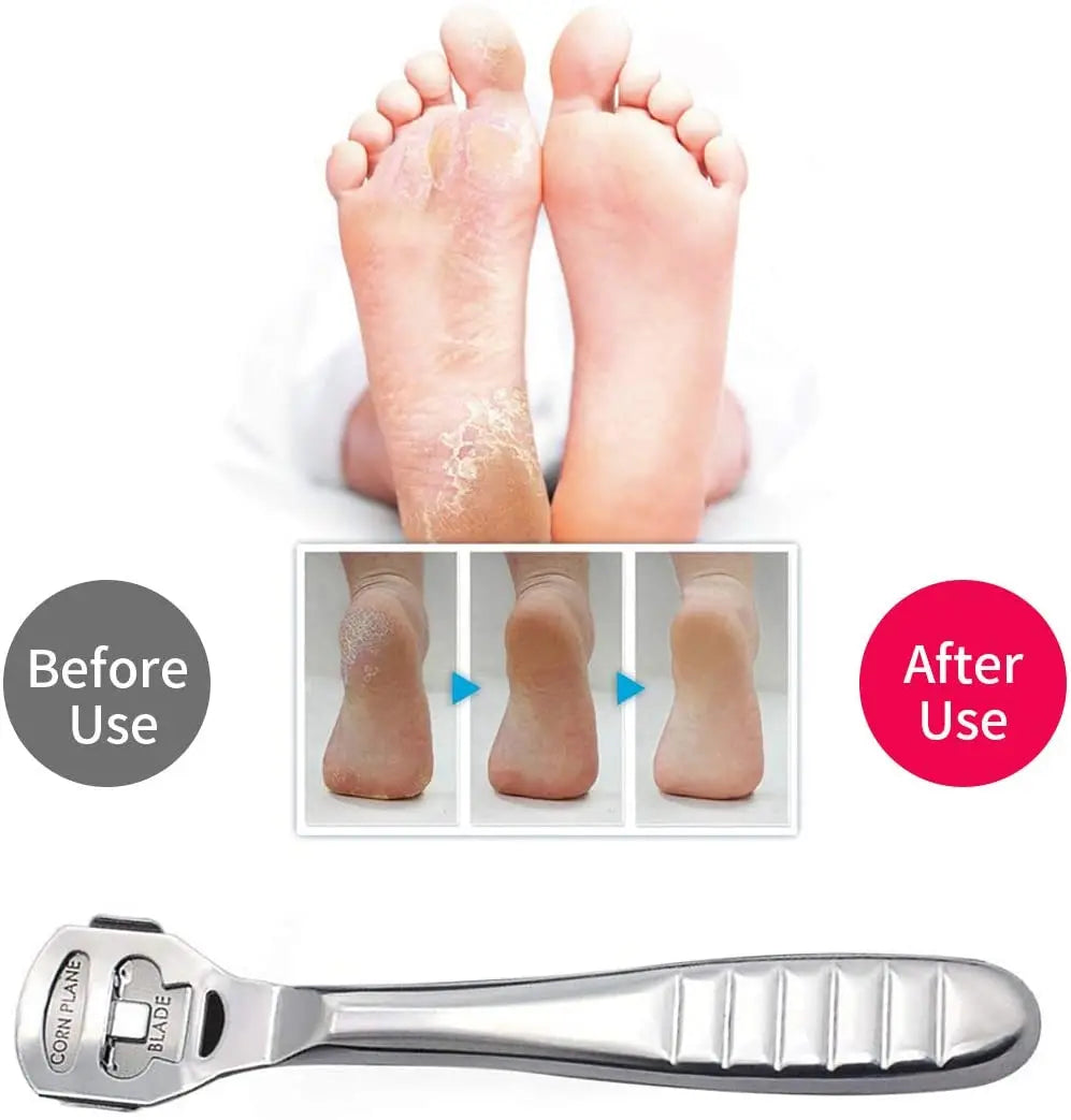 Foot Callus Hard Skin Remover